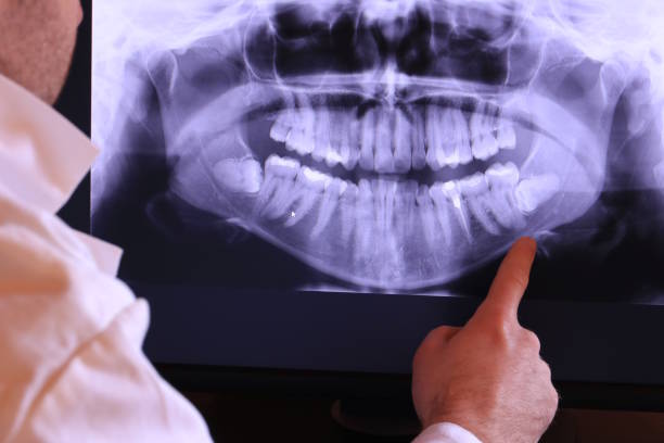 Best Chipped Tooth Repair Near Me  in Oklahoma, PA